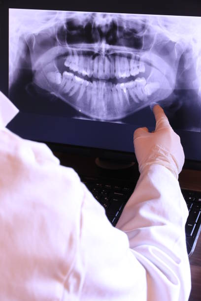 Best Emergency Tooth Extraction in Fritch, TX